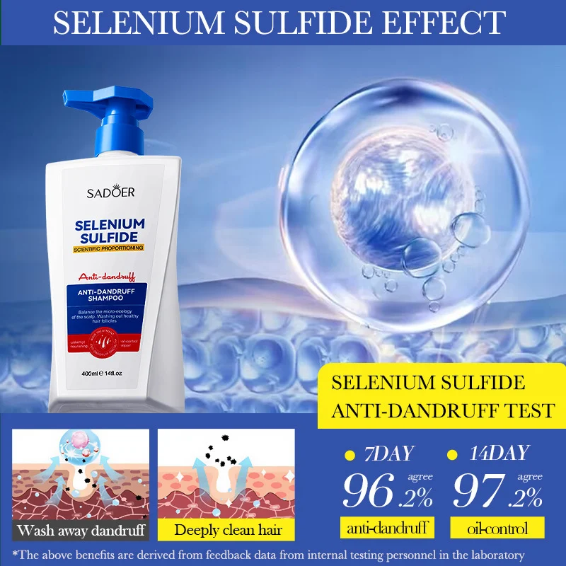 Selenium Sulfide Anti-Dandruff Shampoo for Oily Scalp Control SADOER - Review 1 SADOER Selenium Sulfide Anti-Dandruff Shampoo